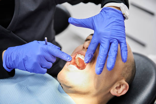 Best Emergency Tooth Extraction in North Puyallup, WA