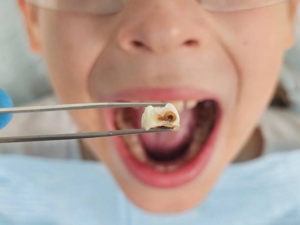 Best Weekend Emergency Dentist in North Puyallup, WA